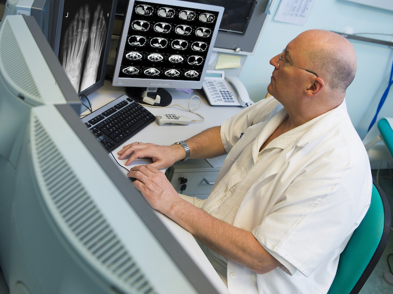 MRI scans in the data age